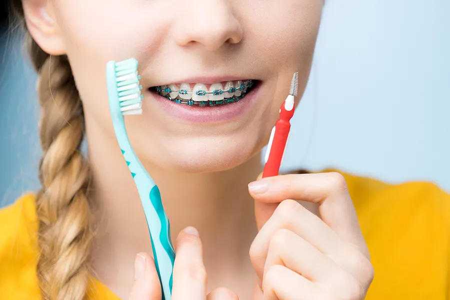 Brushing and Flossing with Braces